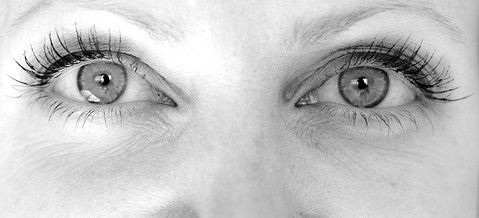 Eyelid surgery pitfalls: know what to avoid